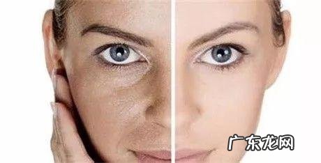 水光针价格是多少 水光针的主要功效