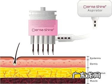 水光针价格是多少 水光针的主要功效