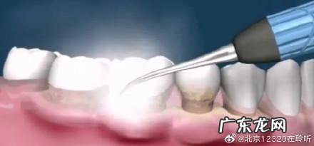 中老年怎样保护牙齿最好 老年人怎样保护牙齿健康