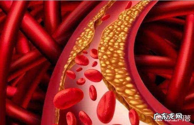 人瘦血压高胆固醇又高,是什么原因?