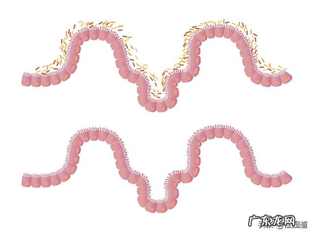 大肠息肉摘除后是否会再长?肠息肉切除后多长时间复查比较合适?