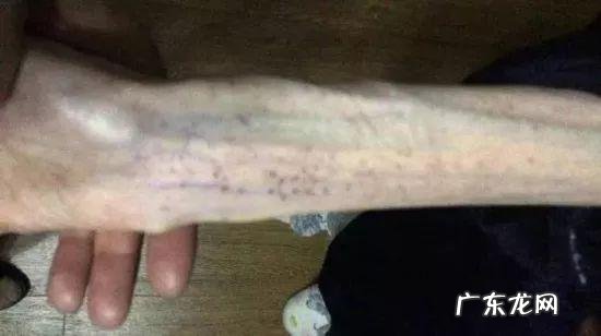 效果很好的减肥药,每粒成本1毛钱!更可怕的在后头…