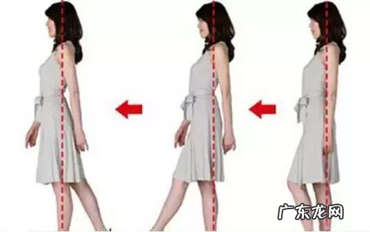 女性腿不直怎么办能矫正吗