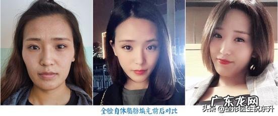 自体脂肪填充隆胸后如何护理?