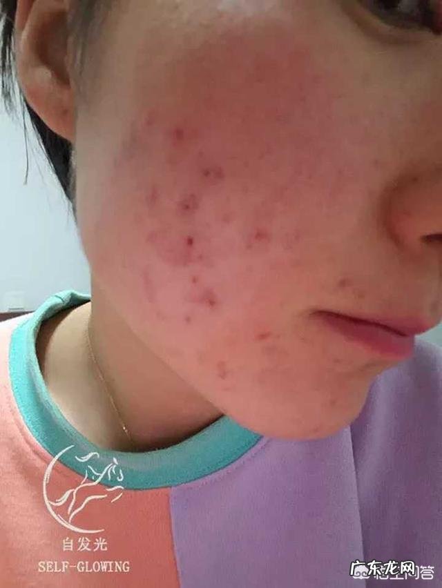 女生为了变好看变漂亮能有多拼