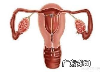 上环后需要注意些什么?饮食需要注意吗?