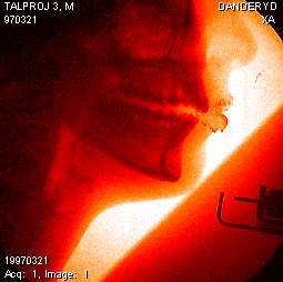 如何保持自己好听的声音?