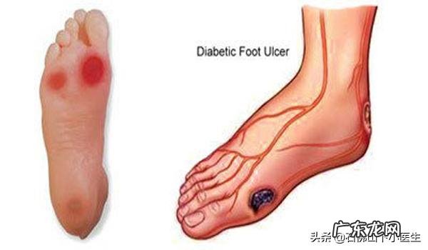 小狗小便次数太多是不是有什么问题啊？