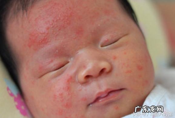 怀孕最后一个月需要排胎毒吗?