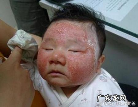 怀孕最后一个月需要排胎毒吗?