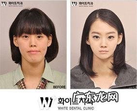 韩国首尔地铁因投诉太多将全面禁止整容广告说明了什么问题