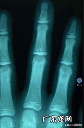 手机有什么软件可以拍X光片?