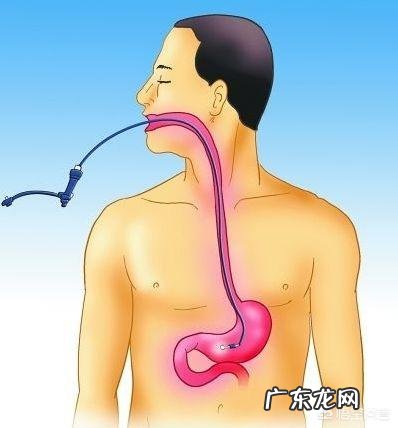 手机有什么软件可以拍X光片?