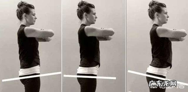 骨盆前倾是怎么回事?可以恢复吗?