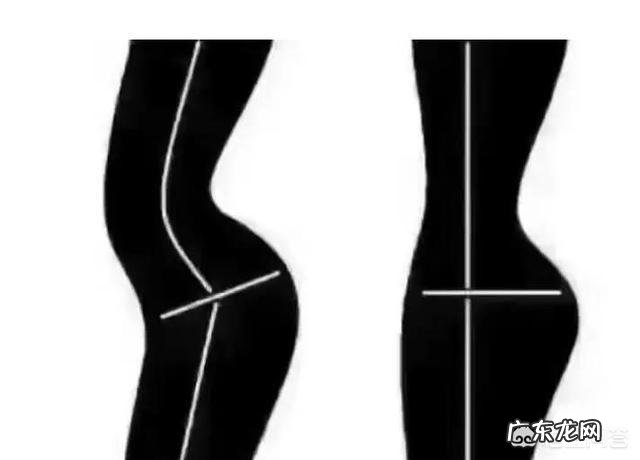 骨盆前倾是怎么回事?可以恢复吗?