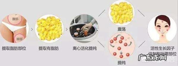 全脸脂肪填充后老了会怎么样?