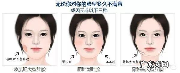 多久可以看出瘦脸针瘦脸的效果