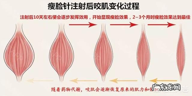 多久可以看出瘦脸针瘦脸的效果