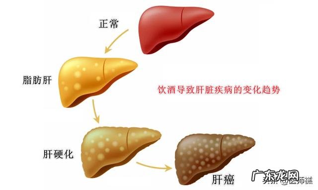 啤酒肚易患脂肪肝,怎么消除肝脏里的油脂