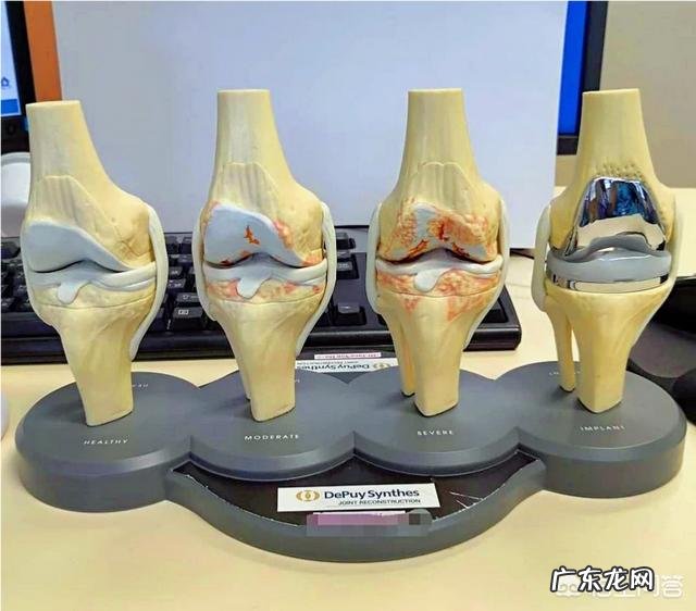 高血糖患者能否通过空腹跑步来降低血糖?注意什么?