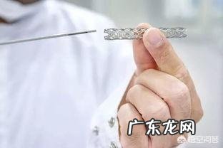 血管里装支架后平均能用多少年?