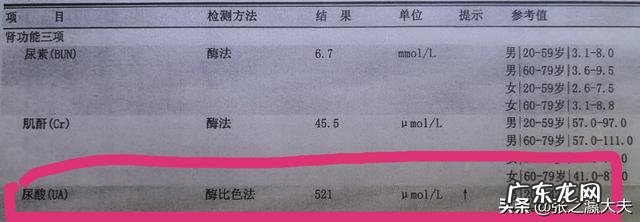 尿酸升高,通过改善哪些生活习惯,可以把尿酸降下来?