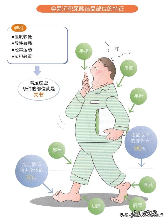灵魂拷问,如何面对一个超ji肥胖,浑身长满痛风石不卫生的丈夫?