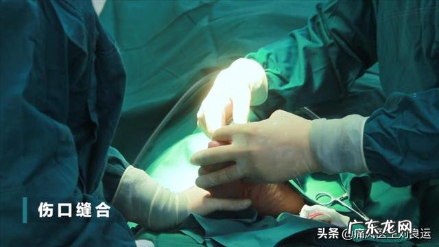 灵魂拷问,如何面对一个超ji肥胖,浑身长满痛风石不卫生的丈夫?