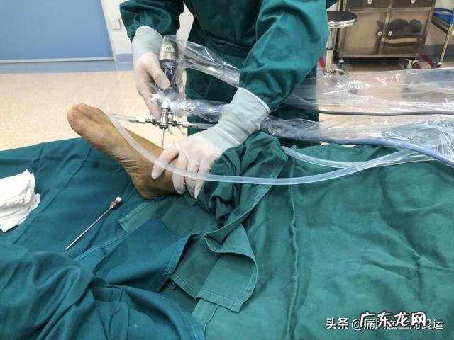 灵魂拷问,如何面对一个超ji肥胖,浑身长满痛风石不卫生的丈夫?