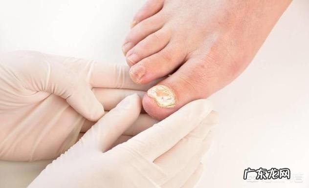 三伏天，用姜盐水泡脚，坚持一周后，身体会出现哪些奇妙变化