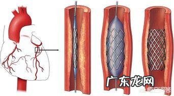 人类若攻克癌症,那人类普遍寿命可以达到100岁吗