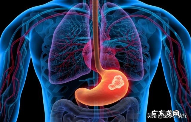 花滑世锦赛上，中国男选手为什么亲吻女搭档肚子他们是情侣吗