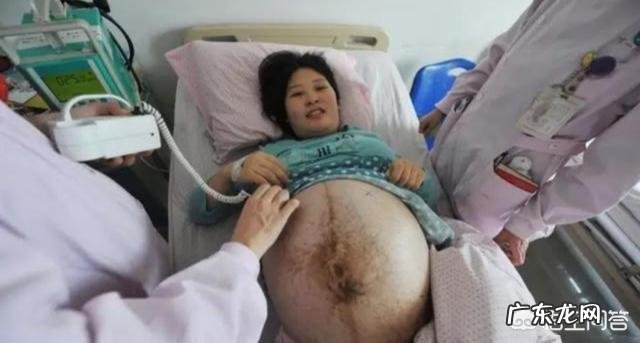 妊娠纹是怀孕之后才会有的吗？