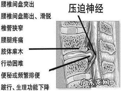 听说肚子上有些穴位只要按一按就能达到很好的减肥效果,是真的吗