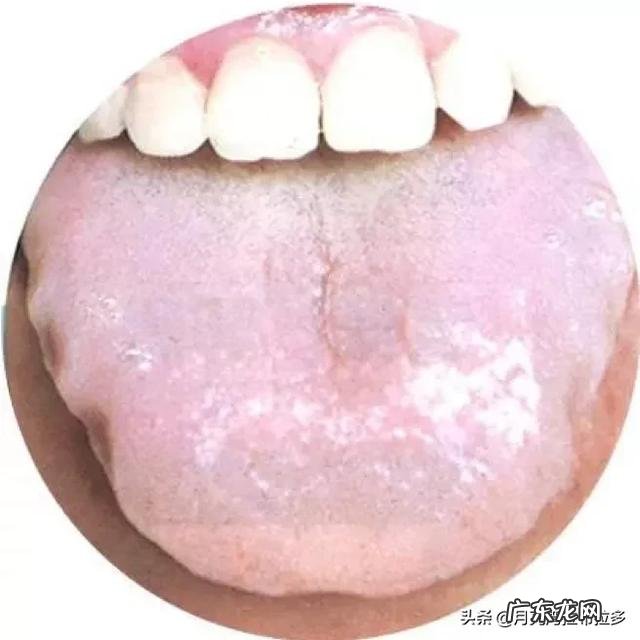 有些中医大夫让你伸舌头,他是想看什么