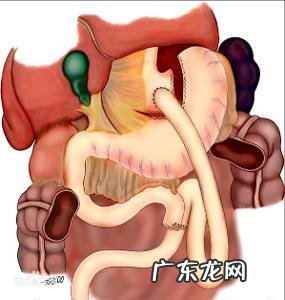 为什么脾胃很虚弱,还胃口很好,吃的很多,长的也很胖?