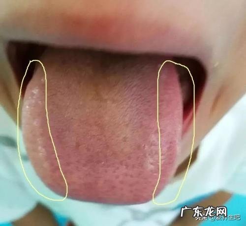 肝火旺失眠最好少吃什么?