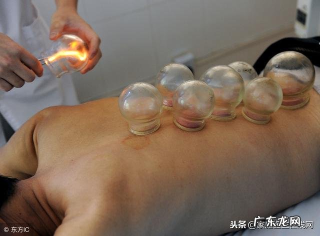 拔罐后起水泡留印,是毒素排出来了答案很快揭晓