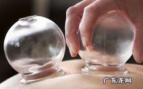 中医拔罐减肥方法怎么样 容易反弹吗