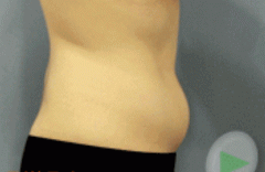 或皮 通过运动减重成功后肉很松怎么办