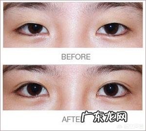 割了双眼皮,怎么眼睛形状都改变了呢,变成了吊眼,好?