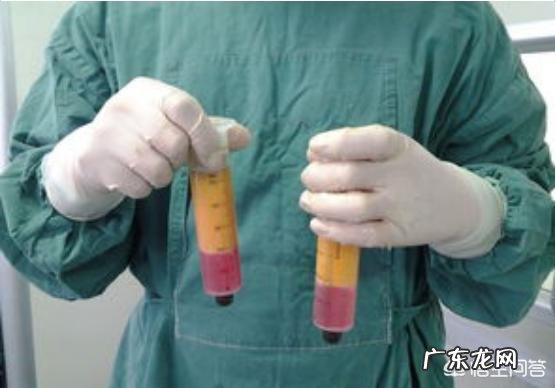 自体脂肪填充后,皮肤为什么会变好?