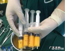 自体脂肪填充后，皮肤为什么会变好？