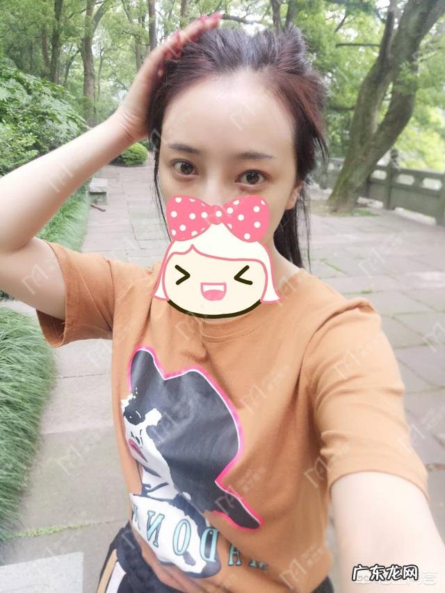 做完双眼皮手术,如何快速恢复?