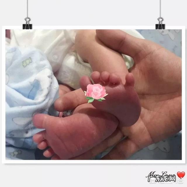 产后脂肪堆积怎么办怎么预防医生推荐的束缚衣能达到束身效果吗