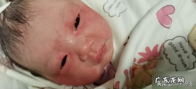 产后三个月了,大肚子还在,有什么好方法可以减掉呢