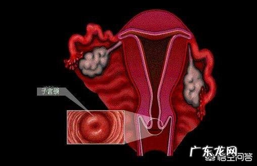 宫颈炎都有哪些症状宫颈炎怎么办