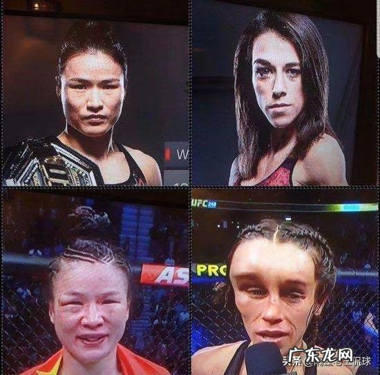UFC决赛过后,乔安娜被曝进医院整容,张伟丽会不会感到内疚?