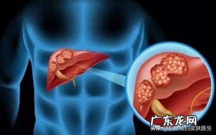 肝不好,先上脸,出现3大症状,小心肝毒太多,指的是哪3个症状