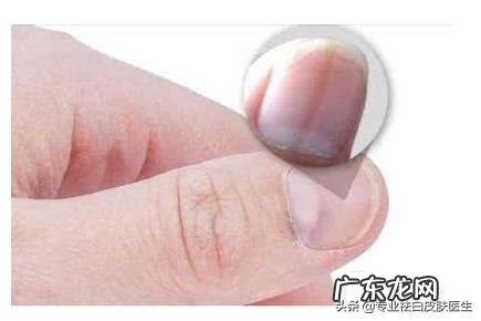 肝不好,先上脸,出现3大症状,小心肝毒太多,指的是哪3个症状